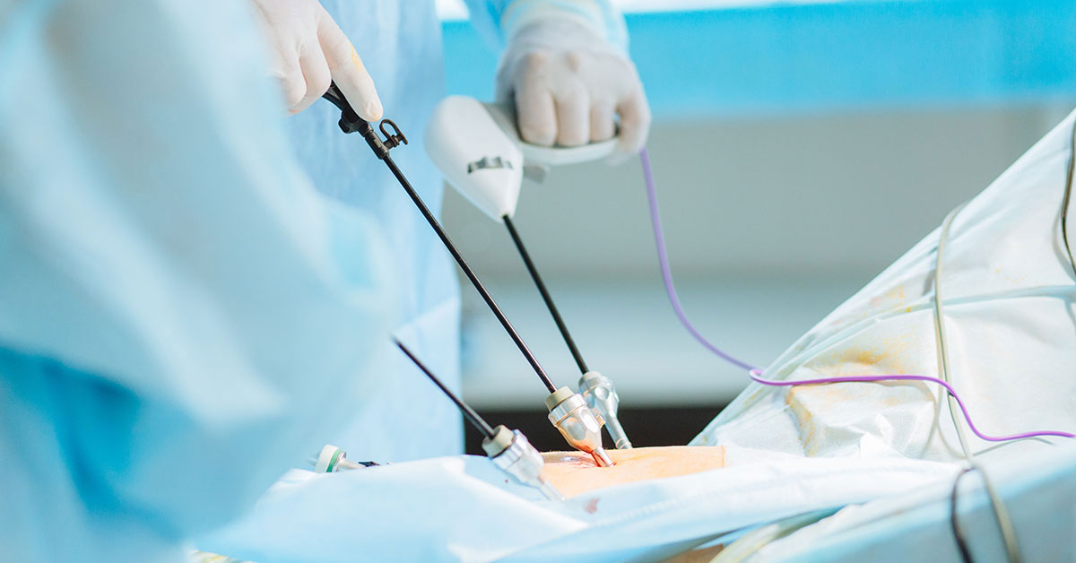 Fertility Enhancing Minimally Invasive Surgery in Vikhroli